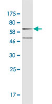 CDH11 monoclonal antibody (M04), clone 1A5