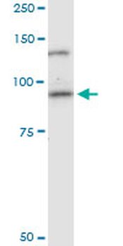 CDH11 monoclonal antibody (M02), clone 1H1