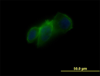 CDH11 monoclonal antibody (M02), clone 1H1