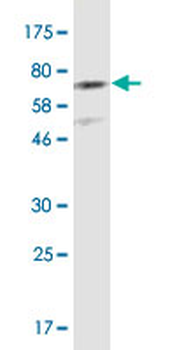CDH11 monoclonal antibody (M02), clone 1H1