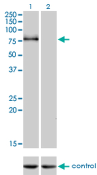 CDH6 monoclonal antibody (M05), clone 2F2