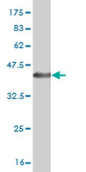 CDH6 monoclonal antibody (M05), clone 2F2