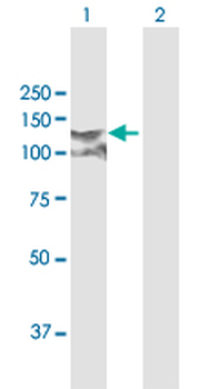 CDH3 MaxPab rabbit polyclonal antibody (D01)