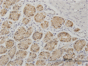 CDH1 monoclonal antibody (M01), clone 3F4