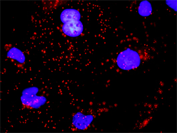 CDH1 monoclonal antibody (M01), clone 3F4