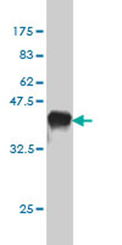CDH1 monoclonal antibody (M01), clone 3F4