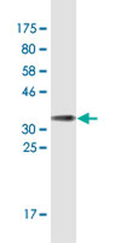 CDC25C monoclonal antibody (M01A), clone 3B11