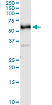 CDC25C monoclonal antibody (M01), clone 3B11