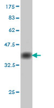 CDC25C monoclonal antibody (M01), clone 3B11