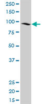 CDC5L polyclonal antibody (A01)