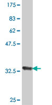 CDC5L polyclonal antibody (A01)