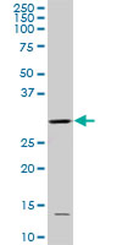 CDC2 monoclonal antibody (M04), clone 8F1