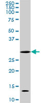 CDC2 monoclonal antibody (M04), clone 8F1