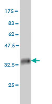 CDC2 monoclonal antibody (M04), clone 8F1