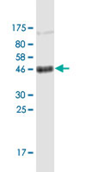 CD151 monoclonal antibody (M02), clone 1B2