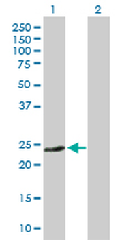 CD74 purified MaxPab rabbit polyclonal antibody (D01P)