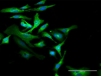 CD59 purified MaxPab rabbit polyclonal antibody (D01P)