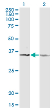 CD58 monoclonal antibody (M02), clone 3B12-D5