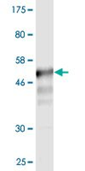 CD58 monoclonal antibody (M02), clone 3B12-D5