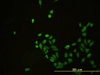 CD58 monoclonal antibody (M01), clone 2D11-B10
