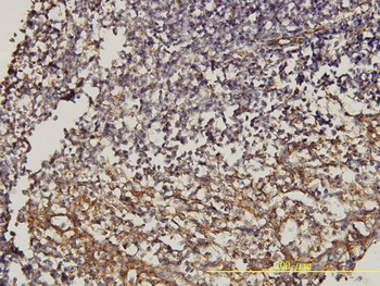 CD58 monoclonal antibody (M01), clone 2D11-B10