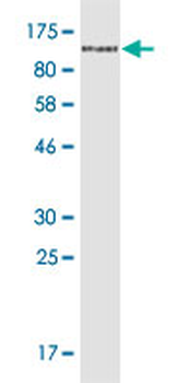 CD44 monoclonal antibody (M05), clone 2H5