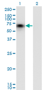 CD44 monoclonal antibody (M03), clone 1E1