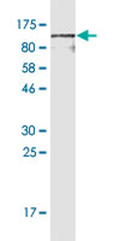 CD44 monoclonal antibody (M03), clone 1E1
