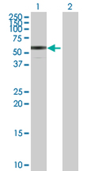ENTPD3 purified MaxPab rabbit polyclonal antibody (D01P)