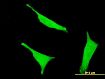 CD38 monoclonal antibody (M02), clone 4G3