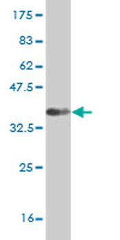 CD38 monoclonal antibody (M02), clone 4G3