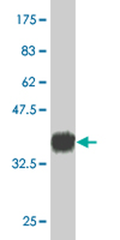 CD34 monoclonal antibody (M02), clone 5A6