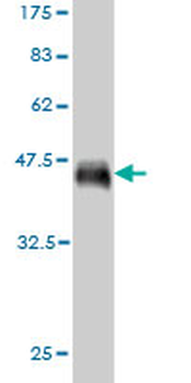 CD34 monoclonal antibody (M01), clone 5F3
