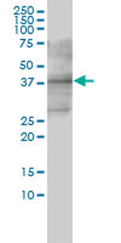 CD33 monoclonal antibody (M01), clone 2D12-G4