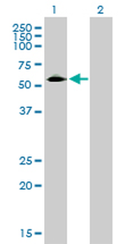 CD33 monoclonal antibody (M01), clone 2D12-G4