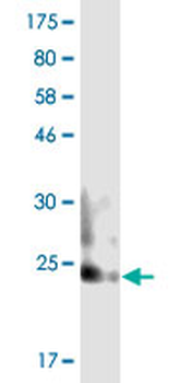 TNFSF8 monoclonal antibody (M02), clone 1E1
