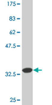 TNFSF8 monoclonal antibody (M01A), clone 2E11
