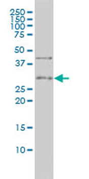 TNFRSF7 monoclonal antibody (M01), clone 1E2-A3