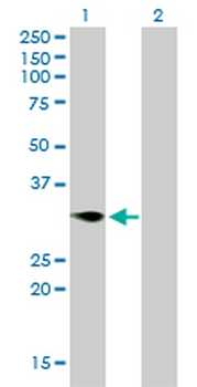 TNFRSF7 monoclonal antibody (M01), clone 1E2-A3