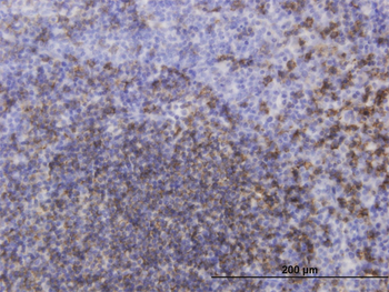 MS4A1 monoclonal antibody (M04), clone 4F11