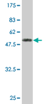 MS4A1 monoclonal antibody (M04), clone 4F11