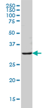MS4A1 monoclonal antibody (M01), clone 5C11