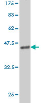 MS4A1 monoclonal antibody (M01), clone 5C11