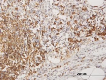 MS4A1 purified MaxPab mouse polyclonal antibody (B01P)