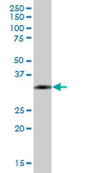 MS4A1 purified MaxPab mouse polyclonal antibody (B01P)