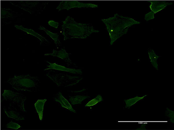 CD19 monoclonal antibody (M02), clone 1C9