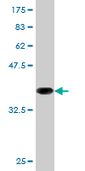CD19 monoclonal antibody (M02), clone 1C9