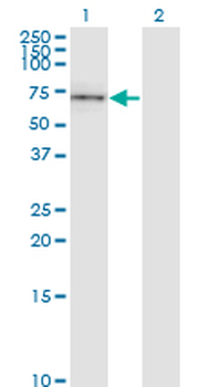 CD19 monoclonal antibody (M01), clone 1G3