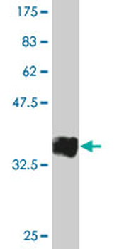 CD19 monoclonal antibody (M01), clone 1G3