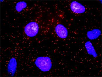 CD19 purified MaxPab rabbit polyclonal antibody (D01P)